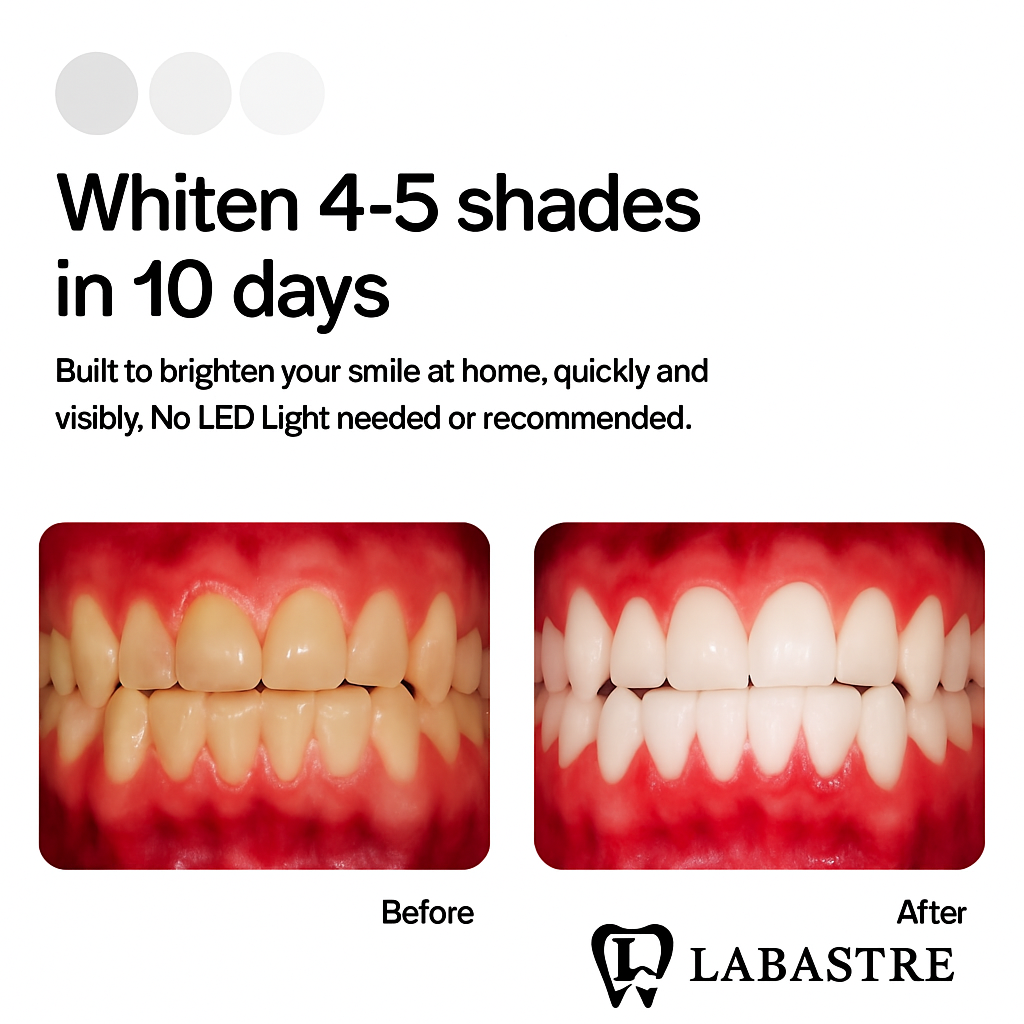 Teeth Whitening Trays