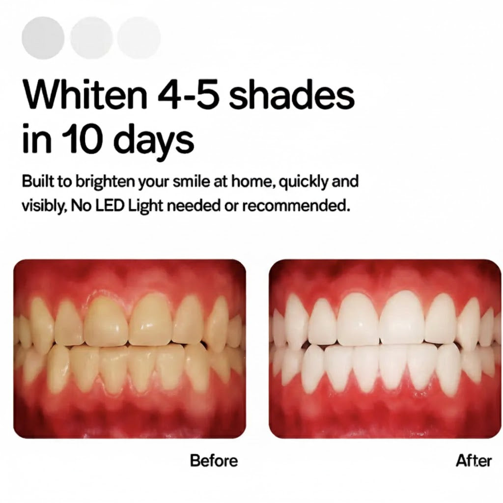 Smile Whitening Kit